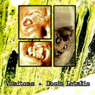 Vomitoma + Dosis Letalis β Painting The Walls With Vomit Cassette